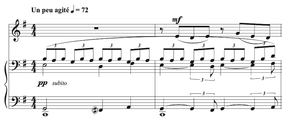 Sheet music in 4/4 time marked ‘Un peu agité’ at 72 BPM. The upper melody is marked mezzo-forte (mf), while the accompaniment features triplets and sudden shifts to pianissimo (pp) labeled ‘subito,’ creating a dynamic contrast.